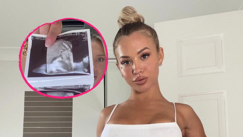 Auf Ultraschallfoto: Tammy Hembrows Baby hat zwölf Finger