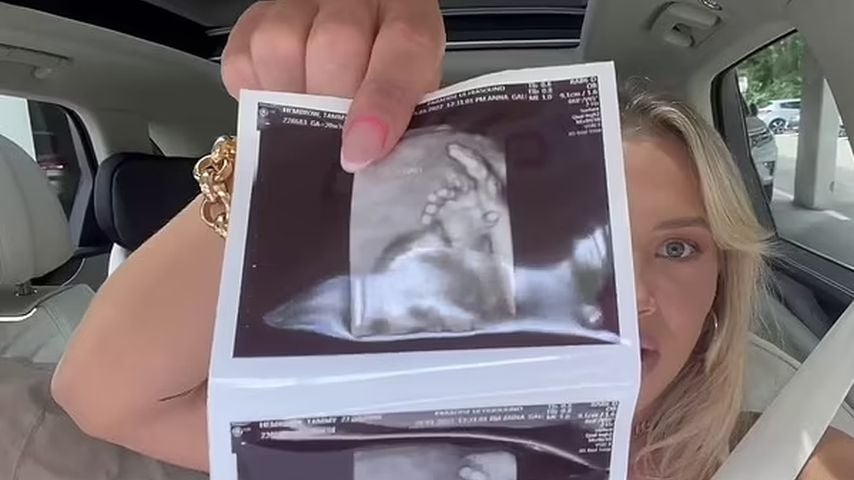 Tammy Hembrows Ultraschallbild
