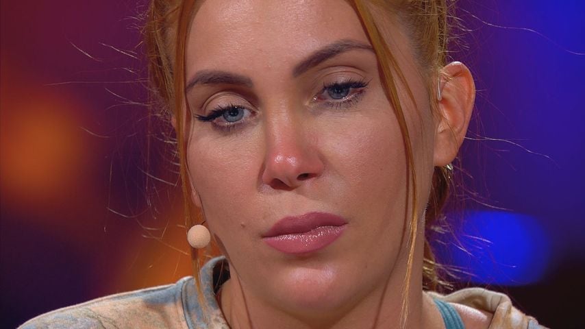 Tara Tabitha verbrennt sich bei "Sommerhaus der Stars"-Dreh