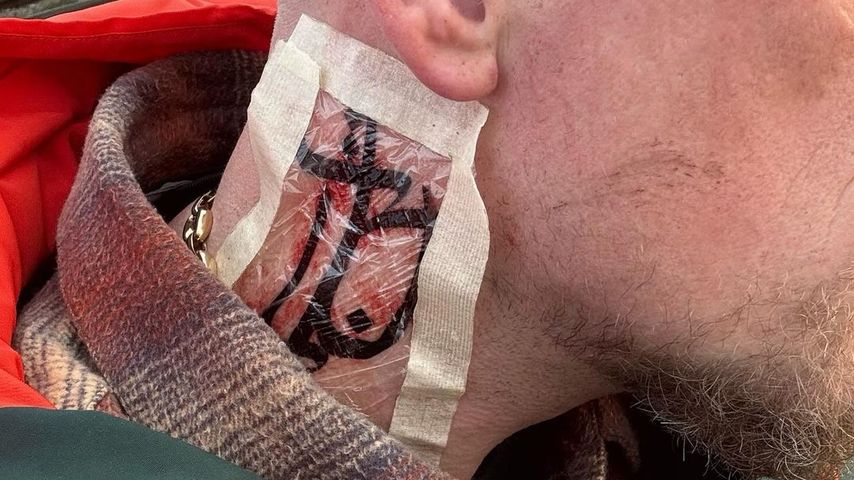Bonez MC präsentiert auf Instagram das frisch gestochene Bushido-Logo