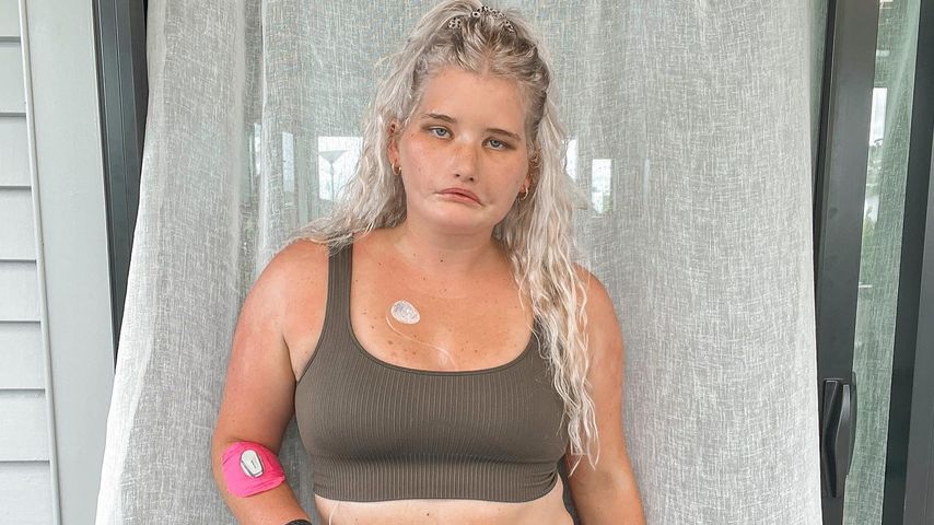 "Mädchen ohne Lachen": Paralympionikin bekommt Modelvertrag