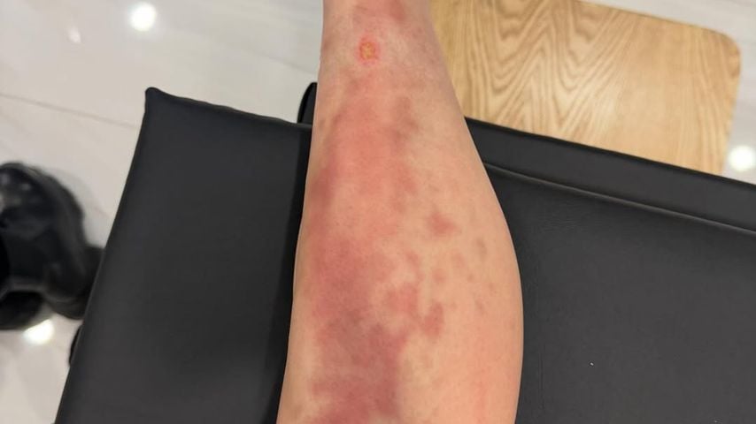 Taylor Momsens Bein, April 2026