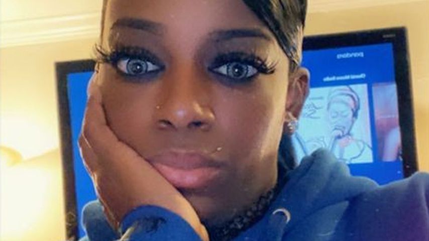 Wie Gorilla Glue Girl: Rapper klebt sich Becher an Lippe