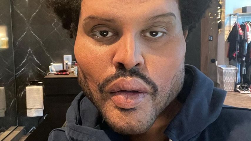 Dieser Mann steckt hinter The Weeknds Gesichtsveränderung