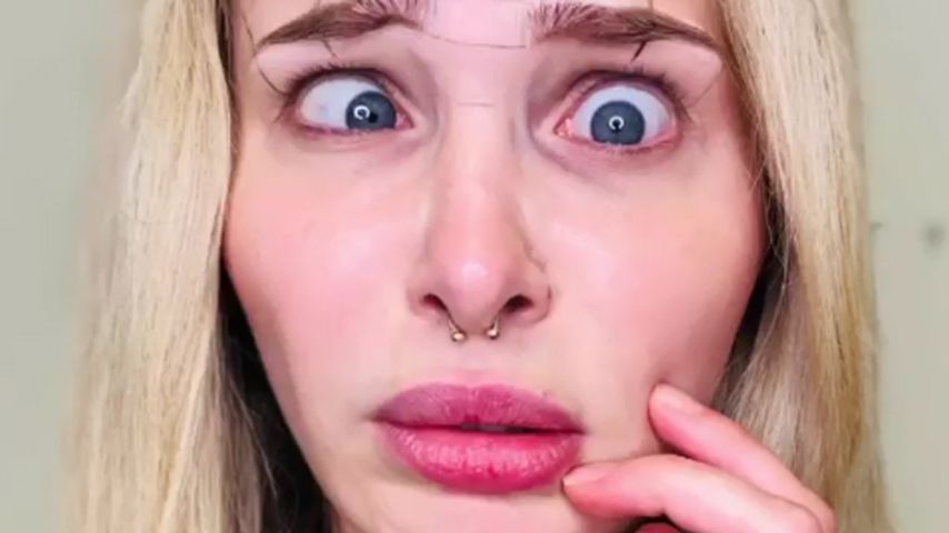 Schönheits-OP? Theresia Fischer war beim Beauty-Doc!