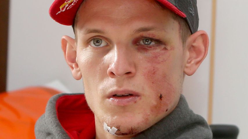 Horror-Sturz! Top-Skispringer auf Intensivstation
