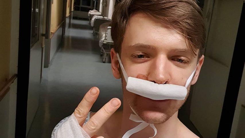 Autsch! Was ist denn nur mit Hottie Timur Bartels passiert?