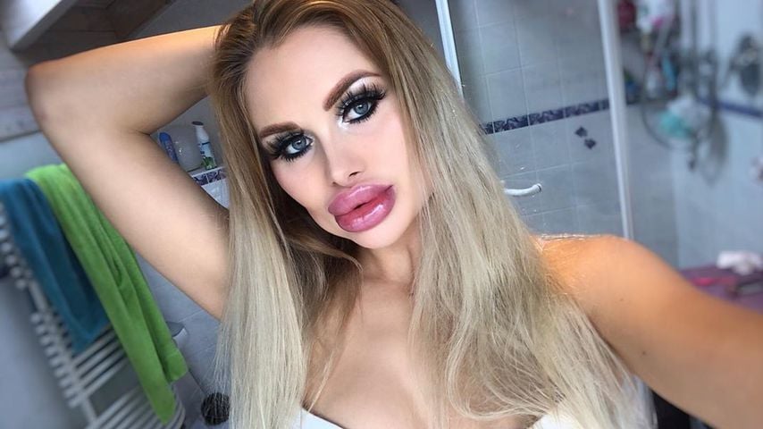 XXL-Lippen: Deutsche Influencerin will Barbie 2.0 werden!