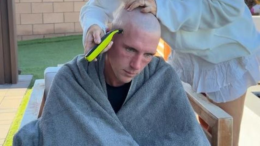 Kampf gegen Haarausfall: Tobi Wolf rasiert sich eine Glatze
