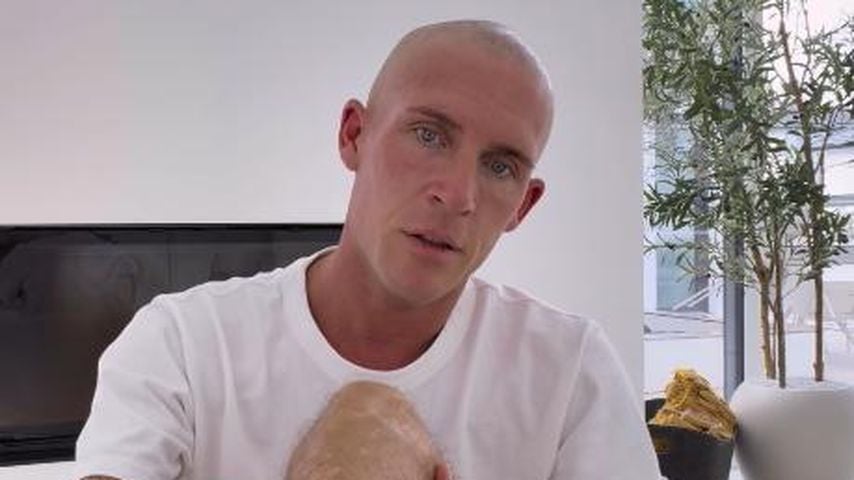 Influencer Tobias Wolf fallen die Haare am ganzen Körper aus