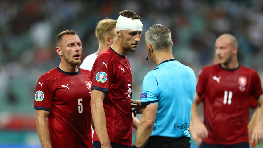 Blut am Kopfverband: Tschechien-Kicker spielt einfach weiter