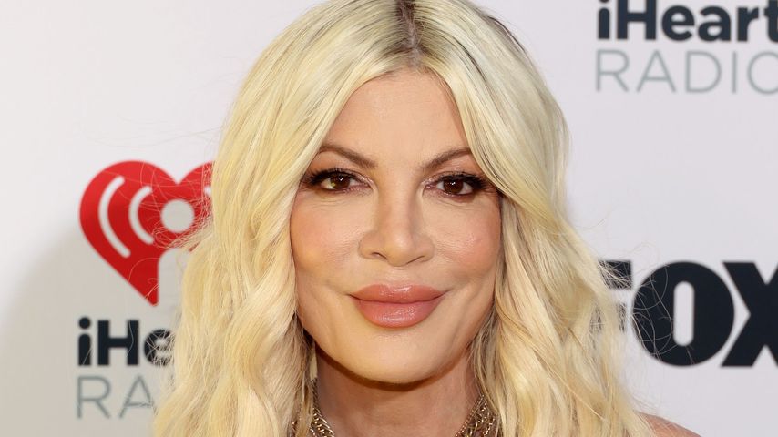 Zahn abgebrochen: Er verletzte Tori Spelling beim Küssen!