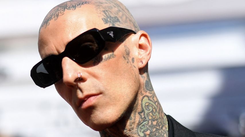 Nach zwei Fingerbrüchen: Travis Barkers Hand wird operiert