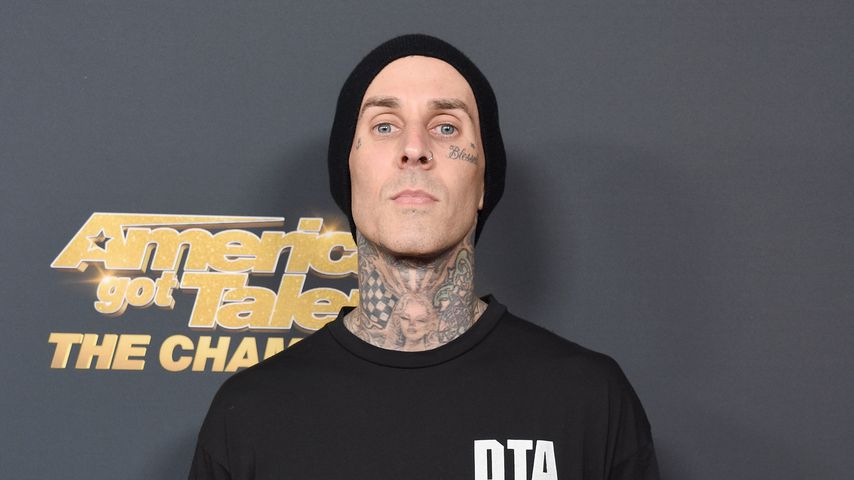 Autsch! Punkrocker Travis Barker schockt mit Ekel-Verletzung
