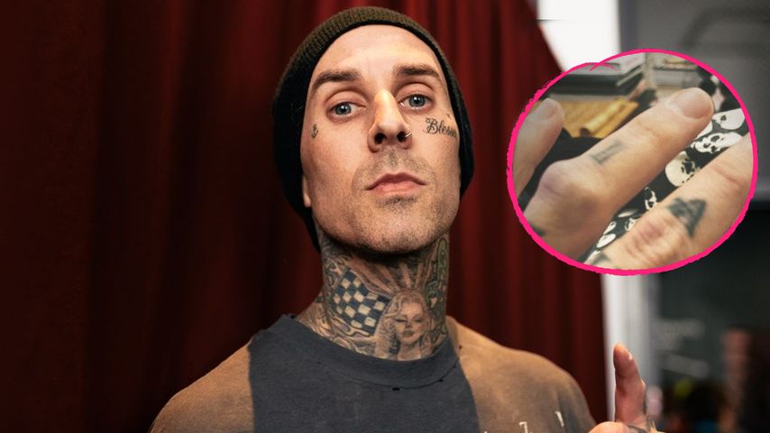 Travis Barker bricht sich zum zweiten Mal seinen Finger