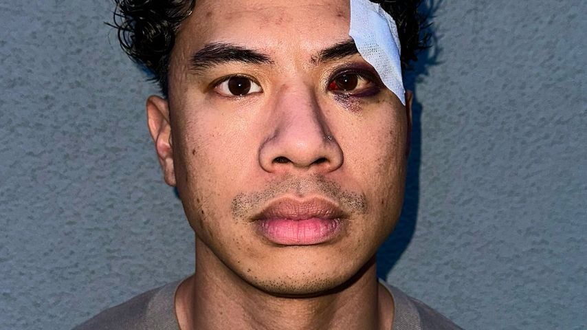 Auf offener Straße: Comedian Tutty Tran wurde verprügelt