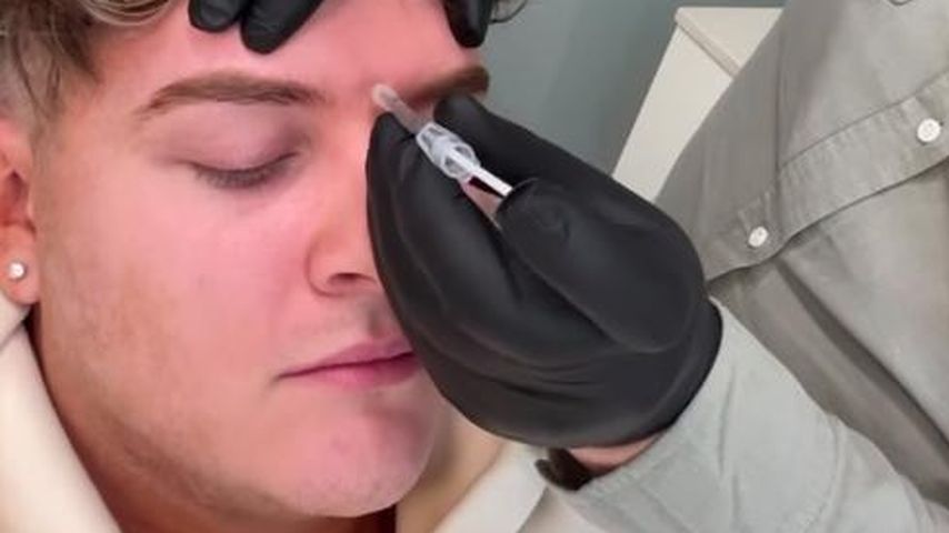 Twenty4tim (22) erzählt offen: Er lässt sich Botox spritzen!
