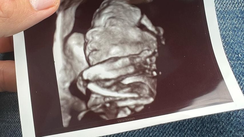 Ultraschallfoto von Ufo361s Nachwuchs