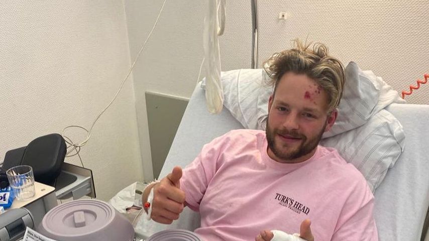 Schock: UK-"Love Island"-Ollie Williams stürzte vom Balkon!