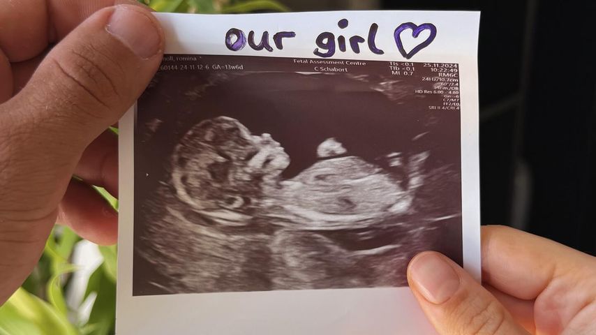 Ultraschall von Christian Wolf und Romina Palms Baby