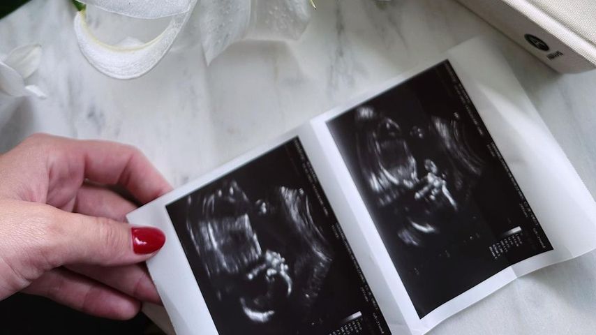 Ultraschall von Josh Duhamel und Audra Maris Baby