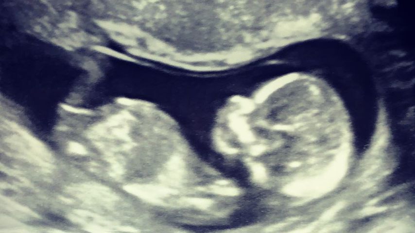 Baby-Alarm: Dieser "Teen Mom"-Star ist wieder schwanger!