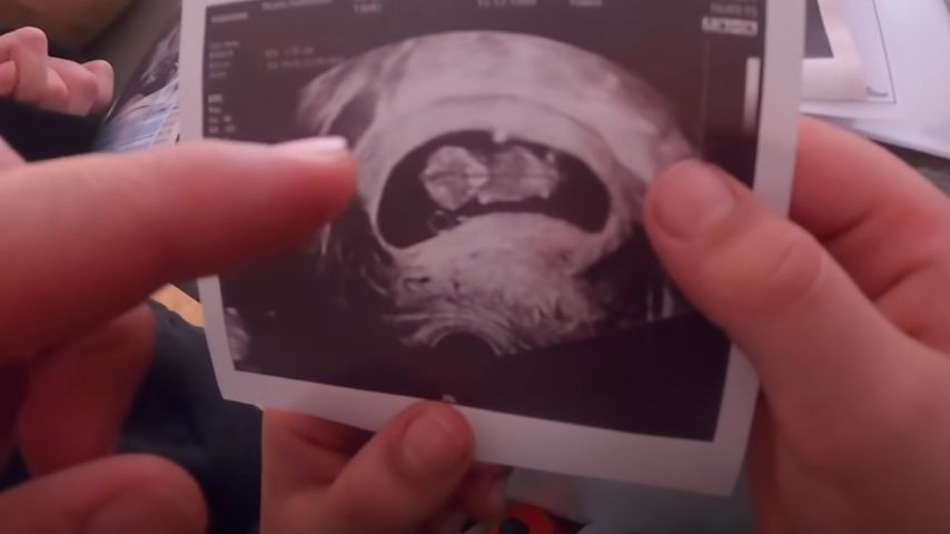 Ultraschallbild der Jindaouis