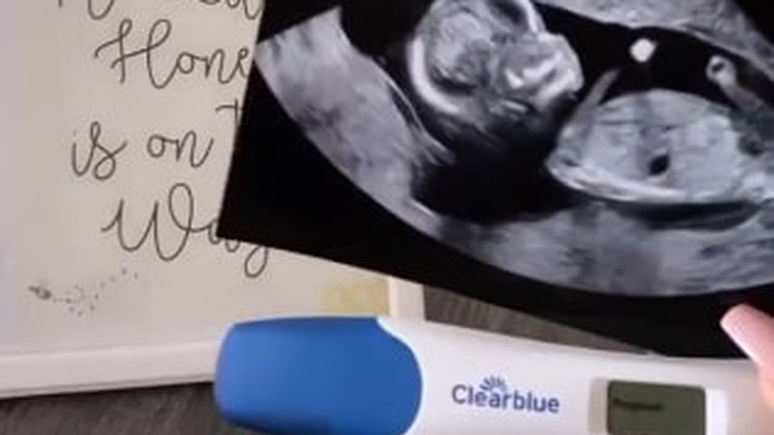 Ultraschallbild und Schwangerschaftstest von Scheana Shay