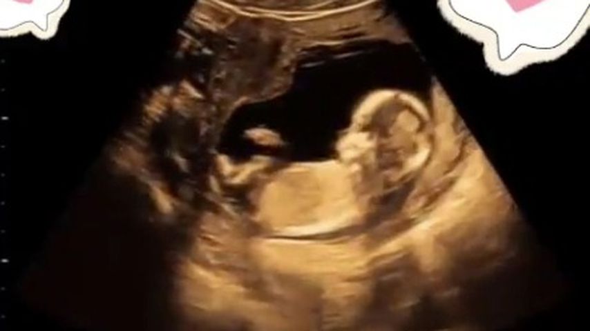 Ultraschallbild von Christin Kaebers Baby