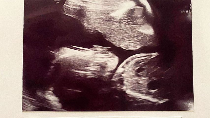 Ultraschallbild von Emily B und Fabolous