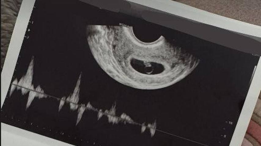 Ultraschallbild von Enyadres' Baby, Mai 2025