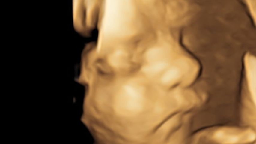 Ultraschallbild von Hilaria Baldwins Baby, Juli 2022
