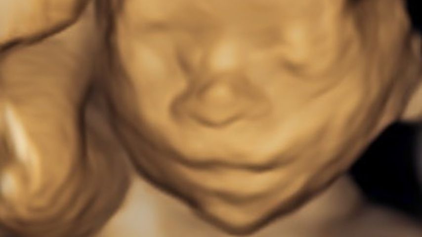 Ultraschallbild von Hilaria Baldwins Baby