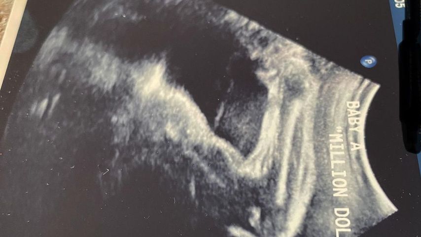 Ultraschallbild von Hilary Swank
