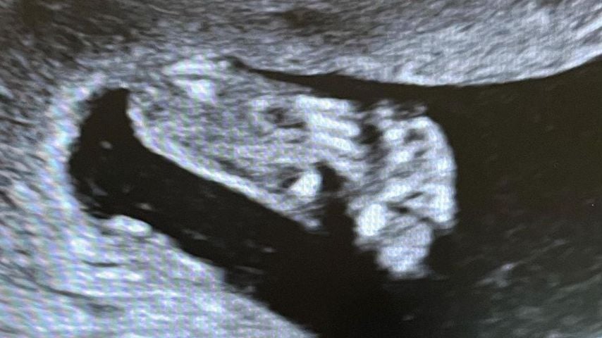 Ultraschallbild von Jessie Caves viertem Baby