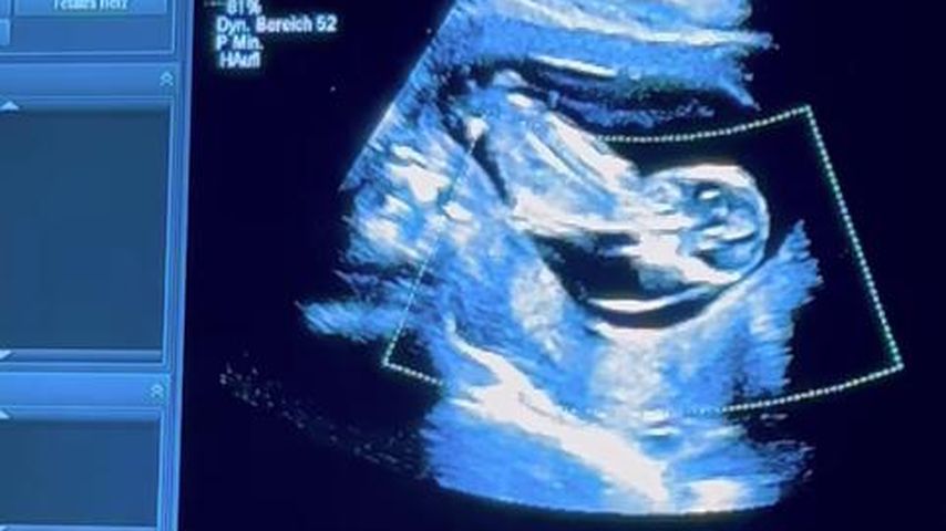 Ultraschallbild von Mola Adebisis Baby, 2024