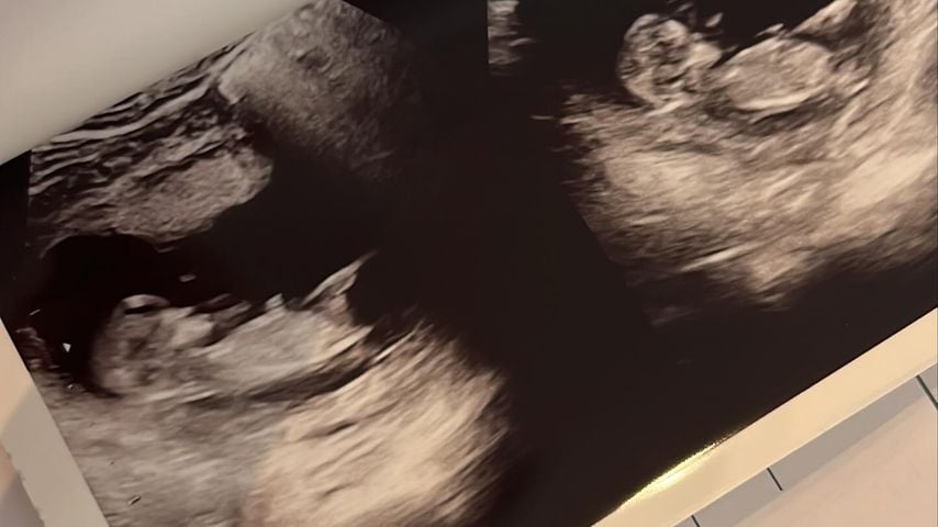 Ultraschallbild von Taddls zweitem Kind