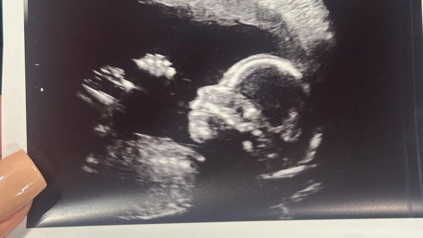 Ultraschallbild von Tamara Hitz' Baby