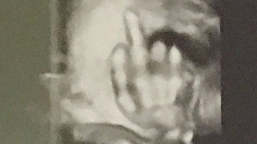Ultraschallbild von Ushers erstgeborenen Sohn