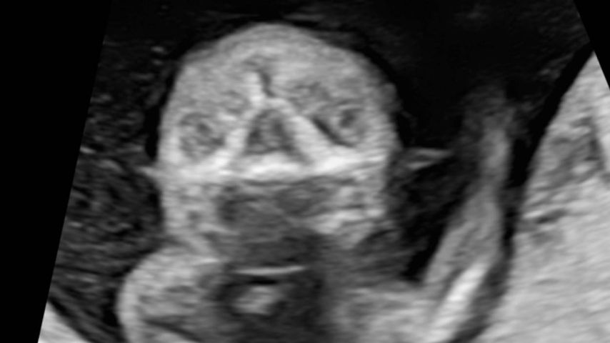 Whitney Cummings zeigt ein Ultraschallbild ihres Babys