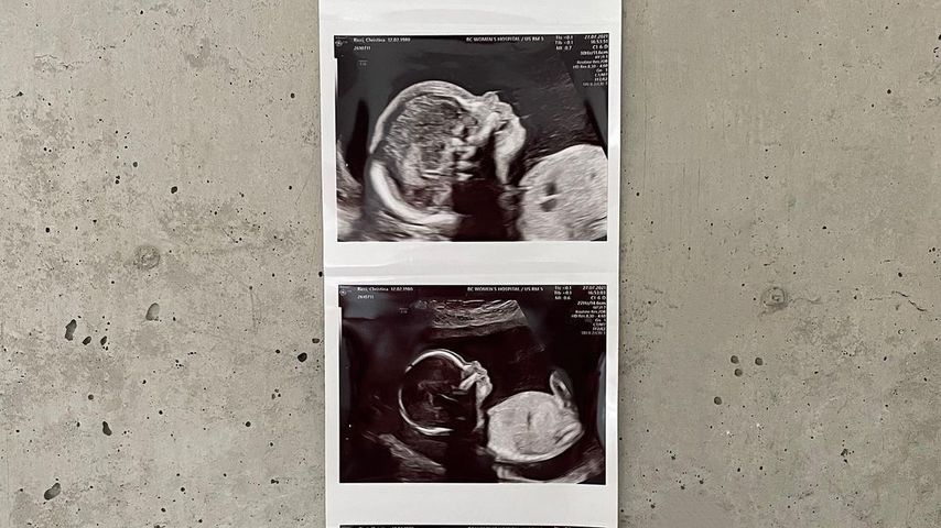 Ultraschallbilder von Christina Ricci und Mark Hamptons Baby