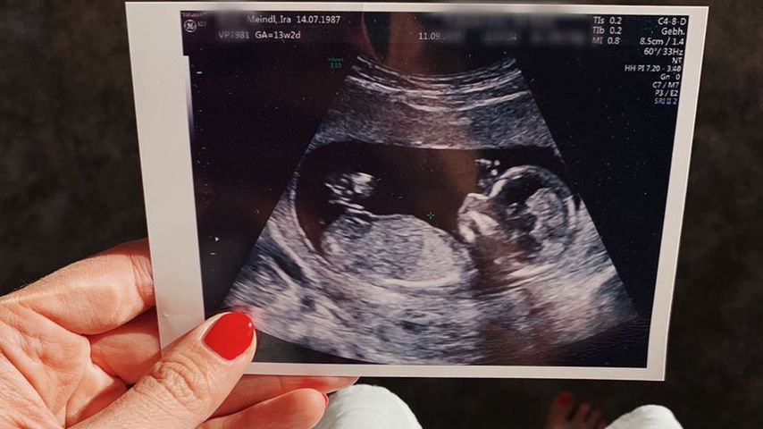 Ultraschallfoto von Ira Meindl