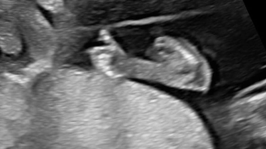 Tanja Makarić teilt ein Ultraschallfoto, August 2025