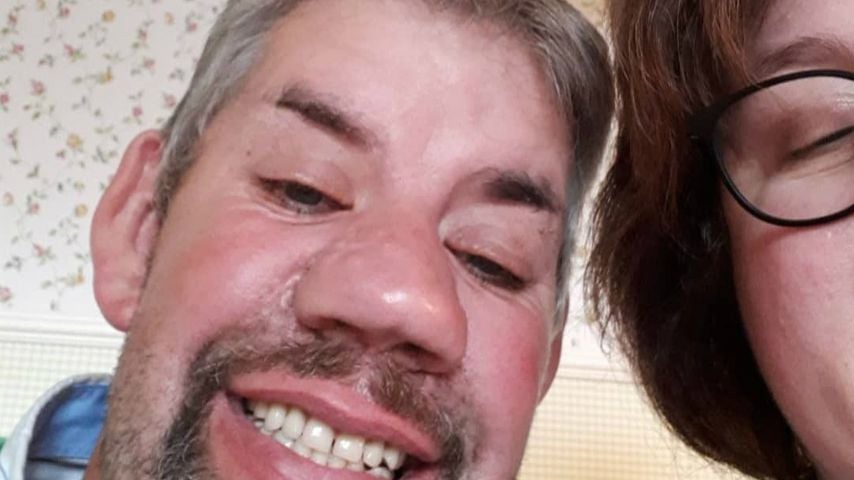 Nach Zahn-OP: Bauer Uwe zeigt stolz seine neuen Zähne!