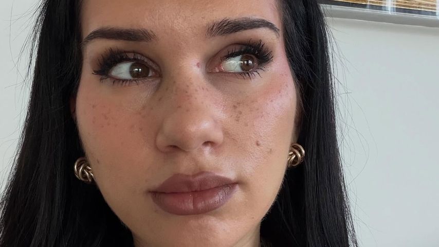 "Gut kaschiert": Nessi Borck macht ADHS-Diagnose öffentlich