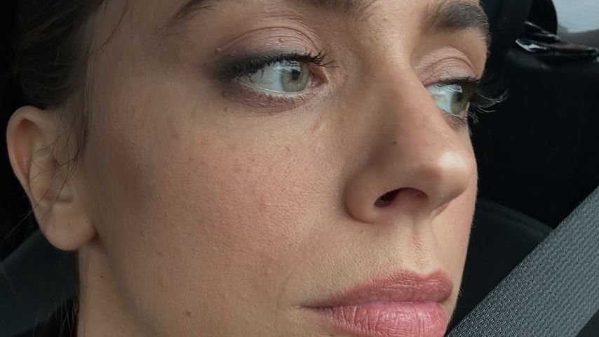 Bei Vanessa Mai wurde eine Krebsvorstufe diagnostiziert