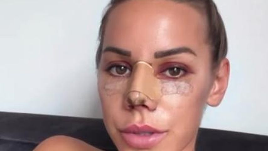 Gesundheitliche Gründe: Vanessa Mariposa hatte eine Nasen-OP