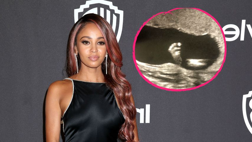 Schwangere "Riverdale"-Beauty Vanessa teilt Ultraschallbild