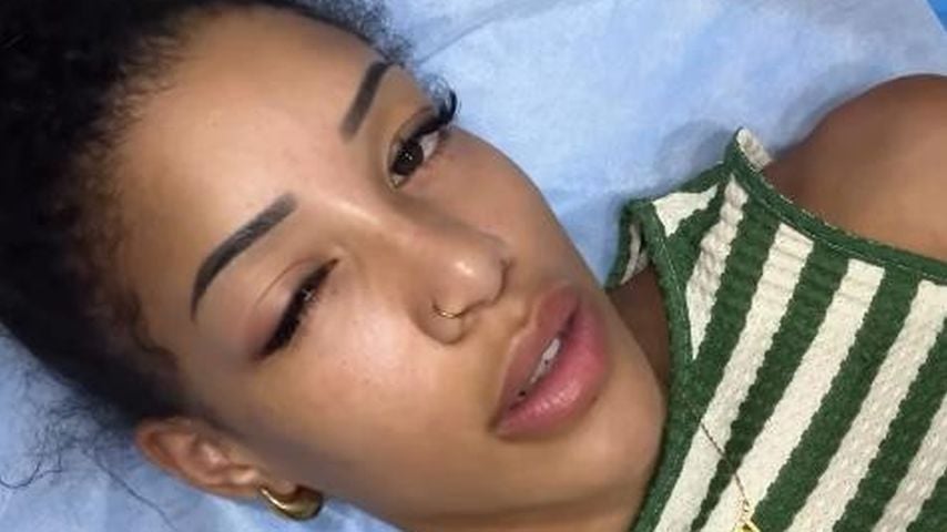 Angeschwollenes Auge: Vanessa Nwattu sucht Krankenhaus auf