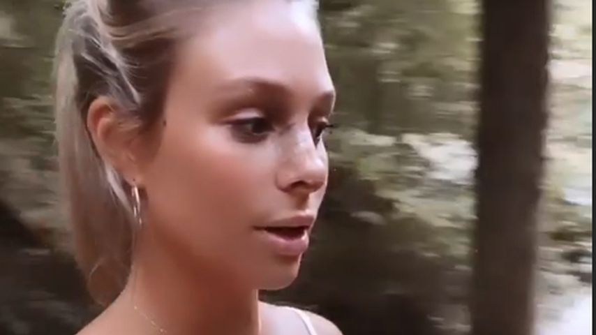 Vanessa Schmitt nach ihrer Nasen-OP